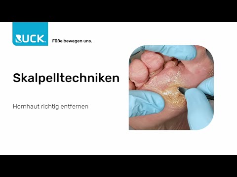 Video: RUCK Skalpellklingen – Anwendung und Klingengrößen