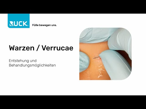 Video: RUCK Skalpellklingen – sterile Einwegklingen für die Fußpflege