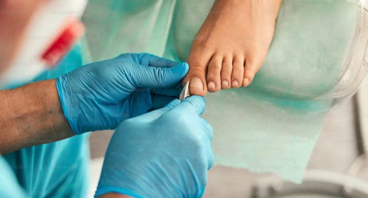 Verdikte teennagels op oudere leeftijd – Gids voor de juiste nageltang